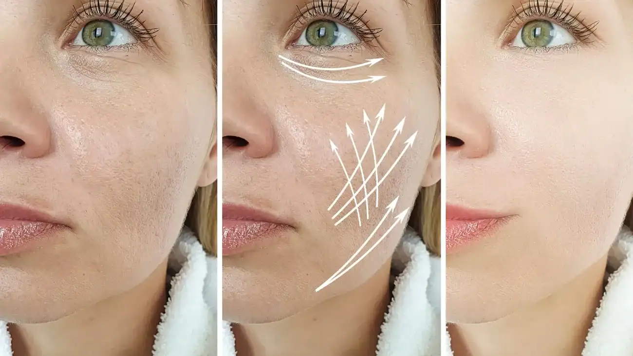 Can One Treatment Really Tackle More Than One Skin Concern Hackney?