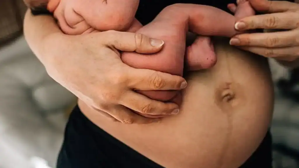 Why Is My Stomach Still Big After Pregnancy Hackney?